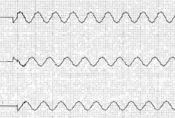 ����a�����þ��l���_�P(gu��n)Ͷ�Еr���ΈD